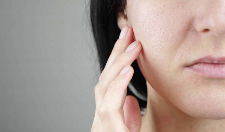 Reducing Facial Pores: Nurture Your Beauty Naturally!